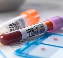 Prostatitis laboratory diagnosis